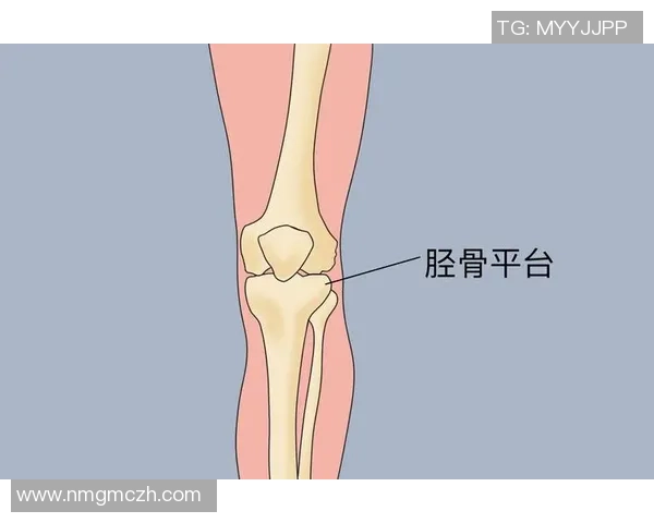 一脚把胫骨踢凹？别慌，咱们把本相说清楚
